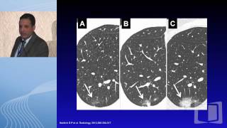 Screen discovered nodules What next [upl. by Tegan]