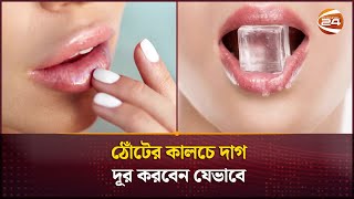 ঠোঁটের কালচে দাগ দূর করবেন যেভাবে  How to get rid of dark spots on lips  Channel 24 [upl. by Robbin494]