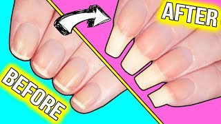 How to GROW YOUR NAILS FAST actually helpful information [upl. by Palmore]