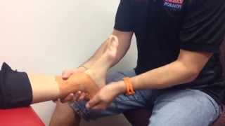 Doctor explains Achilles Tendonitis including causes symptoms and treatment [upl. by Ellimac]