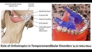 Orthotropics Treatment of Temporomandibular Joint Disorders by Dr Mike Mew [upl. by Bak]