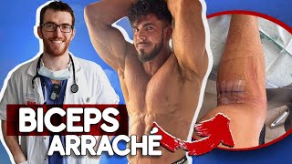 UN DOCTEUR RÉAGIT À LA DÉCHIRURE DU BICEPS DE DAVID CRUCIANI A FITNESS PARK AVEC LE CORONAGYM [upl. by Summer240]