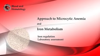 Approach To Microcytic Anemia [upl. by Sedgewick]