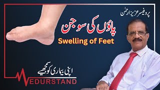 Urdu پاؤں کی سوجن  Swelling Feet  Leg Swelling  Medurstand by Prof Aziz ur Rehman [upl. by Nirehtak]