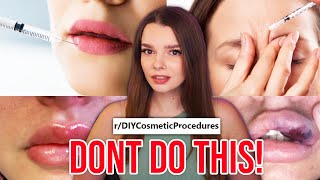 these DIY procedures are a BAD IDEA [upl. by Ezzo633]