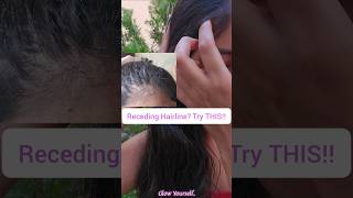 Hairline Hairgrowth Oil❤️ Glow Yourself shorts hair haircare viral [upl. by Schnell959]