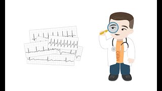 Making sense of common Holter ECG findings [upl. by Emmons905]