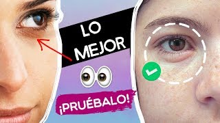 QUITA OJERAS Y BOLSAS 👁✅ EN 1 SEMANA [upl. by Currie35]