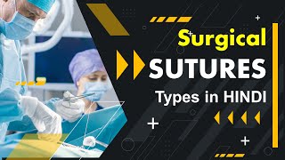 Suture types and their uses in hindi l Suture types l Surgical Sutures [upl. by Kendrick593]