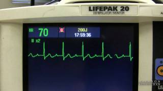 EKG Training Watching and Interpreting the Defibrillator Monitor [upl. by Alveta]