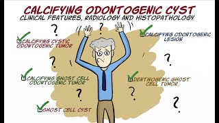 Calcifying Odontogenic Cyst COC [upl. by Issie]