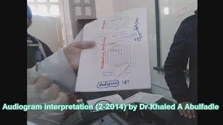 Audiogram interpretation 22014 by Dr Khaled A Abulfadle [upl. by Nahtiek]