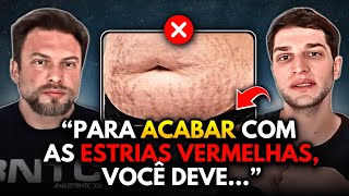 COMO SUMIR COM AS ESTRIAS VERMELHAS DE UMA VEZ  Muzy Explica [upl. by Tiphani679]