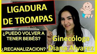 LIGADURA DE TROMPAS ¿PUEDO VOLVER A EMBARAZARME POR GINECOLOGA DIANA ALVAREZ [upl. by Eyllek]