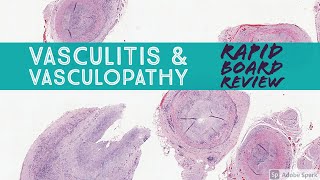 Dermpath Board Review Vasculitis amp Vasculopathy Dermpath Dermatology Pathology [upl. by Simara861]