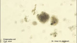 Entamoeba coli cyst [upl. by Stephania725]