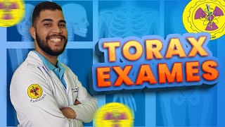 TODAS AS INCIDÊNCIAS DE ROTINA PARA TÓRAX  Radiologando [upl. by Morgenthaler174]