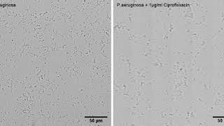 Pseudomonas aeruginosa growth inhibition by 1µgml treatment with Ciprofloxacin [upl. by Assirec]