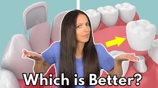 Dental Veneers vs Crowns  Which is Better amp Whats the Difference [upl. by Akcinat]