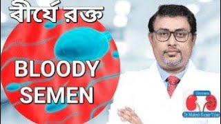 Blood in semenHematospermia causes and treatment  বীর্যে রক্তের কারণ ও চিকিৎসা Dr Mukesh Kr Vijay [upl. by Alita]