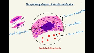 Microscopy series  drawing dystrophic calcification step by step Monckeberg’s arteriosclerosis [upl. by Olcott]