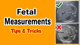 Fetal Measurements Tips and Tricks [upl. by Lucho]