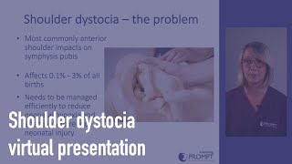 Shoulder dystocia [upl. by Proffitt]