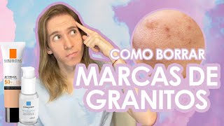 COMO BORRAR MARCAS DE ACNE de manera rápida y segura [upl. by Burman]