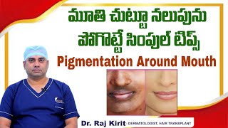 మూతి చుట్టూ నలుపు  How to Get Rid of Pigmentation Around Mouth  Celestee Skin And Hair Clinic [upl. by Fernandez751]