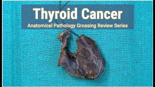 Thyroid Cancer  Neck Dissection  Anatomical Pathology Grossing Review Series [upl. by Elfie465]