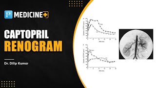 Captopril Renogram Medicine  Dr Dilip Kumar [upl. by Eednim984]