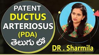 Patent Ductus Arteriosus PDA performed on Premature Baby in Telugu  Sr Pediatrician Dr Sharmila [upl. by Gilbertina937]