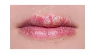 Mayo Clinic Minute 3 things you didnt know about cold sores [upl. by Aivitnahs766]