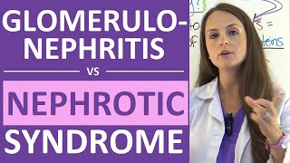 Nephritic Syndrome  Clinical Presentation Causes and Treatment [upl. by Aisyla]