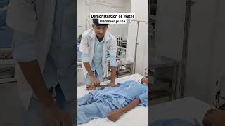 Demonstration of Water Hammer Pulse  In Aortic Regurgitation medical medicine doctor [upl. by Ackley]