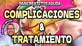 Pancreatitis Aguda  complicaciones y tratamiento [upl. by Carolee]