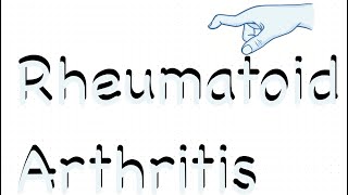 Rheumatology Rheumatoid Arthritis [upl. by Boigie]