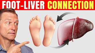 How to Use Your Feet to Diagnose Liver Problems—Dr Berg Explains [upl. by Latisha]