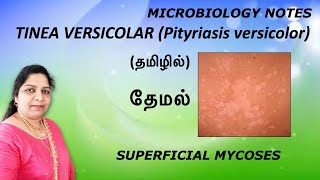 Tinea versicolar Pityriasis versicolar தேமல் Superficial mycosisMicrobiology notes Dr Blessy [upl. by Meehar682]