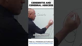 Cerebritis And Cerebral Abscess drnajeeb drnajeeblectures shortvideostatus [upl. by Elgna]