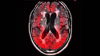 The Aging Brain Week by Week Time Lapse [upl. by Eugine]