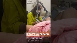 ntimate Bleach Treatment By Dr Chandni Jain Gupta [upl. by Beckerman]