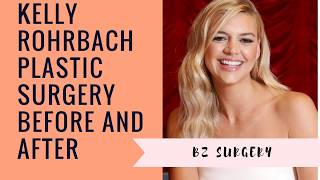 Kelly Rohrbach Plastic Surgery Before and After [upl. by Farron]