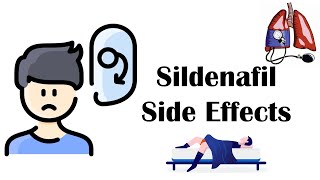 Sildenafil Viagra  Side Effects [upl. by Netneuq]