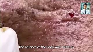 Ultimate Pimple Popping 2024 Gross yet Satisfying Extractions [upl. by Urban]