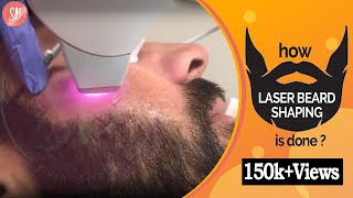 Permanent Laser Beard Shaping Treatment For Men  Beard Laser Hair Removal Men [upl. by Mauchi]