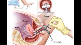 Pemeriksaan Pap Smear [upl. by Schiff]