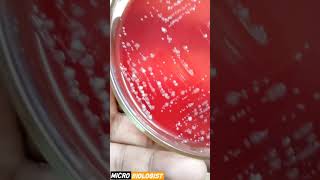 GRAM POSITIVE VS GRAM NEGATIVE BACTERIA GRAM POSITIVE VS GRAM NEGATIVE BACTERIA [upl. by Atinram]