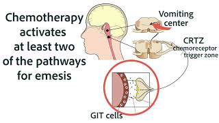 Antiemetics for Chemotherapy and GIT Origins [upl. by Jankell]