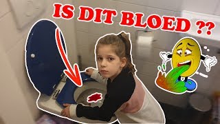 quotMAMA IK HEB BLOED GESPUUGDquot KOETLIFE VLOG [upl. by Edmunda]